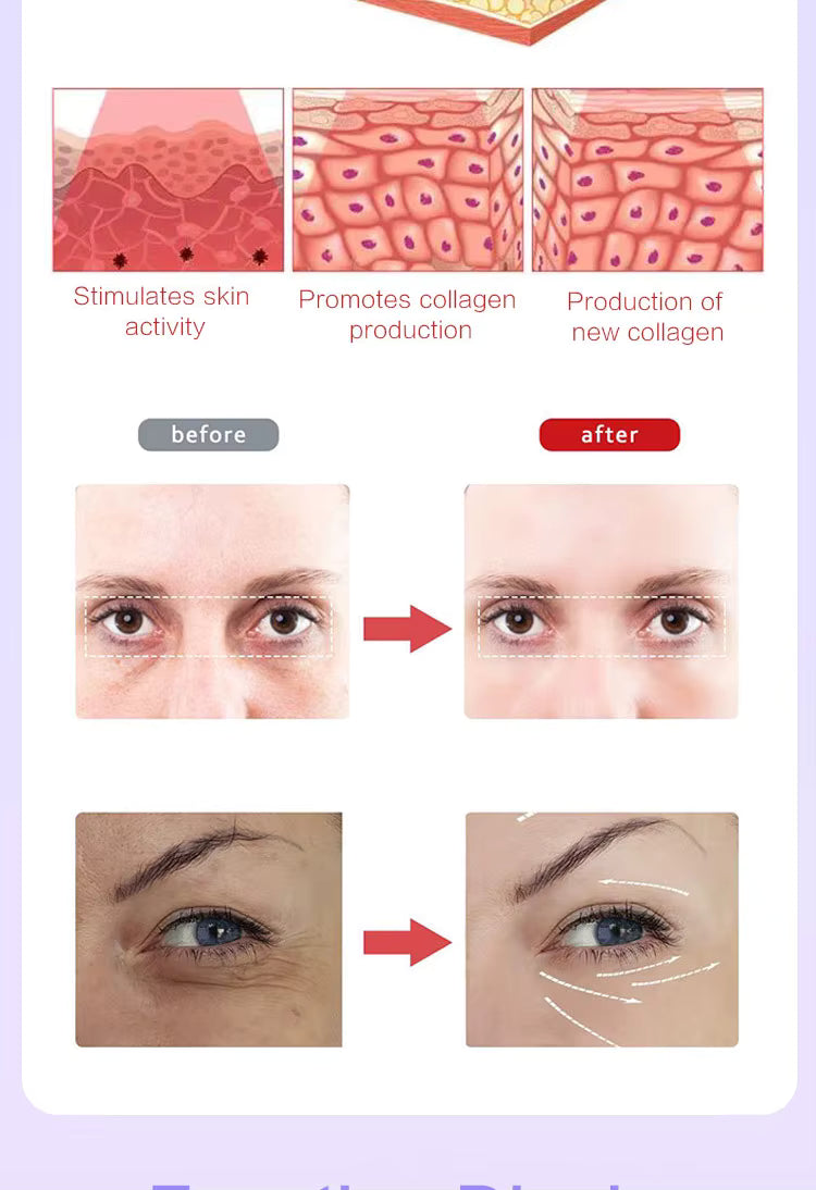 Reducing Dark Circles Eye Pods Massage Red Light Therapy Glasses Under Eye Massager for Puffiness Eye Bags with Microcurrent - TeaseFashion